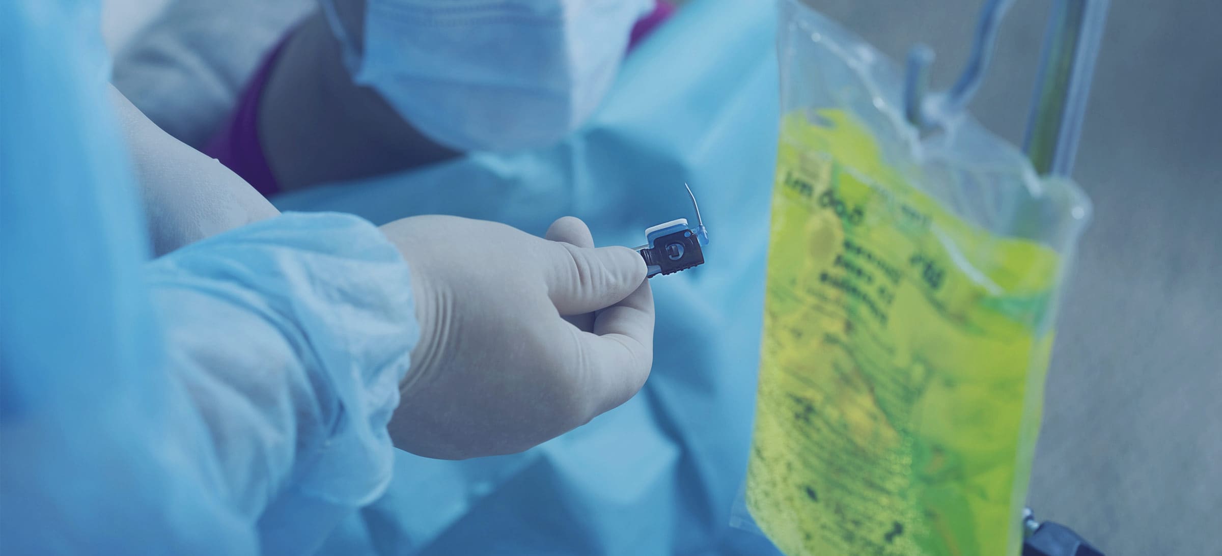 Chirurgie du cancer du côlon